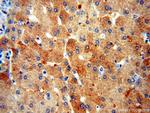 ALDOB Antibody in Immunohistochemistry (Paraffin) (IHC (P))