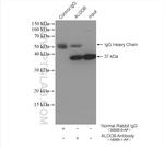 ALDOB Antibody in Immunoprecipitation (IP)