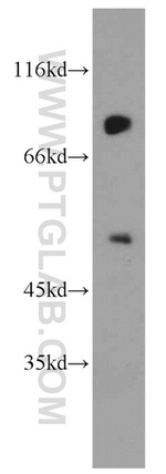 USP49 Antibody in Western Blot (WB)