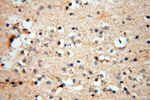 PDH E1 alpha Antibody in Immunohistochemistry (Paraffin) (IHC (P))