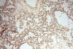 PDH E1 alpha Antibody in Immunohistochemistry (Paraffin) (IHC (P))