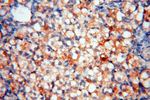 PDH E1 alpha Antibody in Immunohistochemistry (Paraffin) (IHC (P))