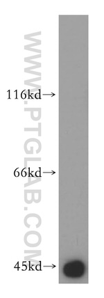 PDH E1 alpha Antibody in Western Blot (WB)