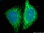 PDH E1 alpha Antibody in Immunocytochemistry (ICC/IF)