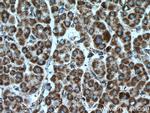 PDH E1 alpha Antibody in Immunohistochemistry (Paraffin) (IHC (P))