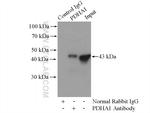 PDH E1 alpha Antibody in Immunoprecipitation (IP)