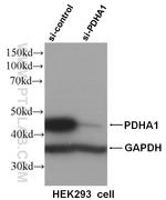 PDH E1 alpha Antibody in Western Blot (WB)