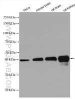 PDH E1 alpha Antibody in Western Blot (WB)