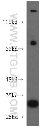 COX18 Antibody in Western Blot (WB)