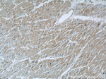 PLA2G4E Antibody in Immunohistochemistry (Paraffin) (IHC (P))