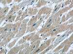 PLA2G4E Antibody in Immunohistochemistry (Paraffin) (IHC (P))