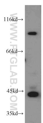 PLA2G4E Antibody in Western Blot (WB)