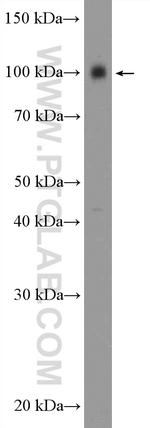 KCNC4 Antibody in Western Blot (WB)