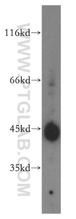 B3GNT3 Antibody in Western Blot (WB)