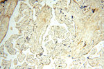 SGCG Antibody in Immunohistochemistry (Paraffin) (IHC (P))