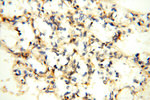 SGCG Antibody in Immunohistochemistry (Paraffin) (IHC (P))