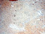 SGCG Antibody in Immunohistochemistry (Paraffin) (IHC (P))