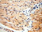 SGCG Antibody in Immunohistochemistry (Paraffin) (IHC (P))