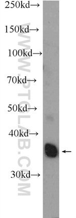 SGCG Antibody in Western Blot (WB)