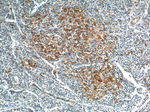 PD-1/CD279 Antibody in Immunohistochemistry (Paraffin) (IHC (P))