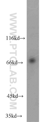 KLHL20 Antibody in Western Blot (WB)