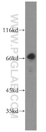 KLHL20 Antibody in Western Blot (WB)