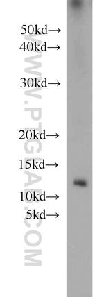 Uroguanylin Antibody in Western Blot (WB)