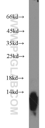 Uroguanylin Antibody in Western Blot (WB)