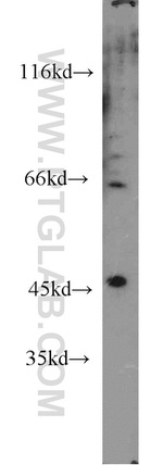 Synaptotagmin-13 Antibody in Western Blot (WB)