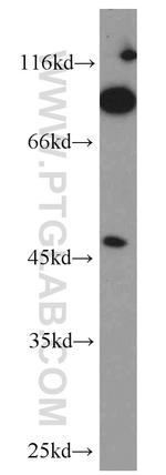 GCNT2 Antibody in Western Blot (WB)