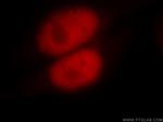 MSH6 Antibody in Immunocytochemistry (ICC/IF)