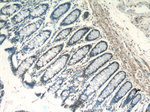 MSH6 Antibody in Immunohistochemistry (Paraffin) (IHC (P))