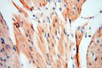 MSH6 Antibody in Immunohistochemistry (Paraffin) (IHC (P))