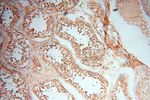 MSH6 Antibody in Immunohistochemistry (Paraffin) (IHC (P))