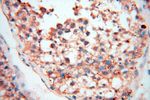 MSH6 Antibody in Immunohistochemistry (Paraffin) (IHC (P))