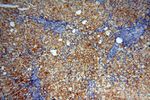 MSH6 Antibody in Immunohistochemistry (Paraffin) (IHC (P))