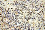 MSH6 Antibody in Immunohistochemistry (Paraffin) (IHC (P))