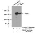 MSH6 Antibody in Immunoprecipitation (IP)