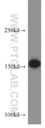 MSH6 Antibody in Western Blot (WB)