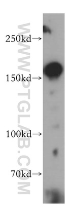 MSH6 Antibody in Western Blot (WB)