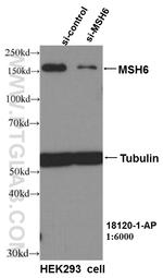 MSH6 Antibody in Western Blot (WB)