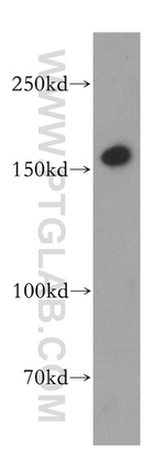 MSH6 Antibody in Western Blot (WB)