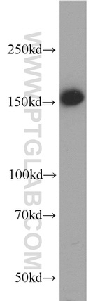 MSH6 Antibody in Western Blot (WB)