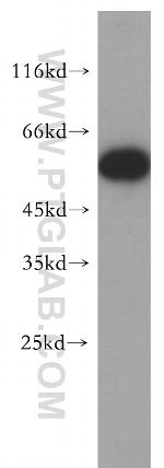 FARSA Antibody in Western Blot (WB)