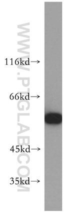 FARSA Antibody in Western Blot (WB)