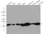 LC8/DYNLL1 Antibody in Western Blot (WB)