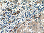 LYN Antibody in Immunohistochemistry (Paraffin) (IHC (P))