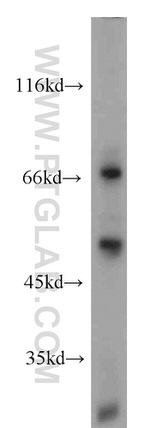 LYN Antibody in Western Blot (WB)