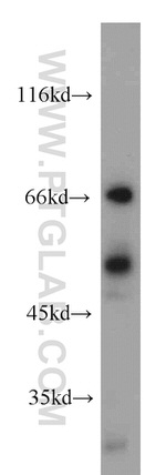 LYN Antibody in Western Blot (WB)