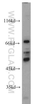 LYN Antibody in Western Blot (WB)